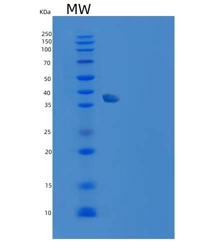 SDS-PAGE analysis of Human CA10 (Carbonic Anhydrase-Related Protein 10) - Recombinant Protein, CAT# BLT-05268P, showing >95% purity under 15% SDS-PAGE (Reduced)Human CA10 (Carbonic Anhydrase-Related Protein 10) - Recombinant Protein