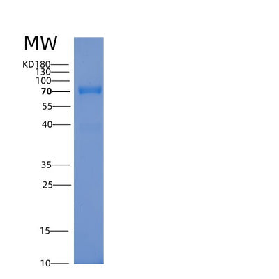 SDS-PAGE analysis of Human RPS6KB1 (Ribosomal Protein S6 Kinase Beta-1) - Recombinant Protein, CAT# BLT-05331P, showing >85% purity under 15% SDS-PAGE (Reduced)Human RPS6KB1 (Ribosomal Protein S6 Kinase Beta-1) - Recombinant Protein