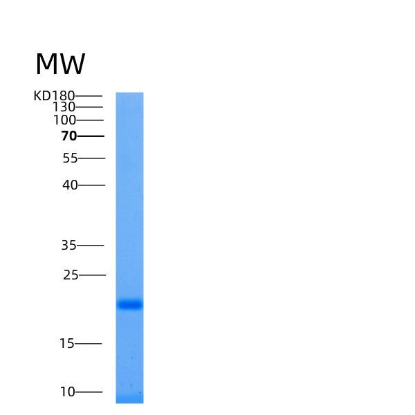 SDS-PAGE analysis of Human UBE2L6 (Ubiquitin/Isg15-Conjugating Enzyme E2 L6) - Recombinant Protein, CATHuman UBE2L6 (Ubiquitin/Isg15-Conjugating Enzyme E2 L6) - Recombinant Protein