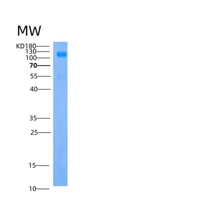 SDS-PAGE analysis of Human IGSF3 (Immunoglobulin Superfamily Member 3) - Recombinant Protein, CAT# BLT-05334P, showing >85% purity under 15% SDS-PAGE (Reduced)Human IGSF3 (Immunoglobulin Superfamily Member 3) - Recombinant Protein