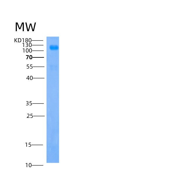 SDS-PAGE analysis of Human IGSF3 (Immunoglobulin Superfamily Member 3) - Recombinant Protein, CATHuman IGSF3 (Immunoglobulin Superfamily Member 3) - Recombinant Protein