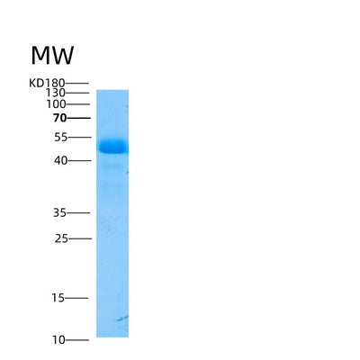 SDS-PAGE analysis of Mouse Smpdl3a (Cyclic Gmp-Amp Phosphodiesterase Smpdl3A) - Recombinant Protein, CAT# BLT-05335P, showing >95% purity under 15% SDS-PAGE (Reduced)Mouse Smpdl3a (Cyclic Gmp-Amp Phosphodiesterase Smpdl3A) - Recombinant Protein