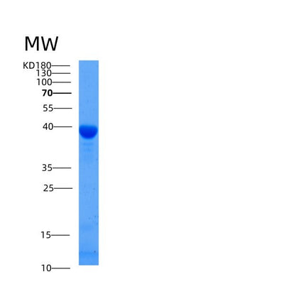 SDS-PAGE analysis of Mouse Gfod2 (Glucose-Fructose Oxidoreductase Domain-Containing Protein 2) - Recombinant Protein, CAT# BLT-05337P, showing >85% purity under 15% SDS-PAGE (Reduced)Mouse Gfod2 (Glucose-Fructose Oxidoreductase Domain-Containing Protein 2) - Recombinant Protein