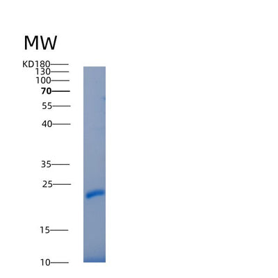 SDS-PAGE analysis of Human IL22RA2 (Interleukin-22 Receptor Subunit Alpha-2) - Recombinant Protein, CAT# BLT-05338P, showing >95% purity under 15% SDS-PAGE (Reduced)Human IL22RA2 (Interleukin-22 Receptor Subunit Alpha-2) - Recombinant Protein