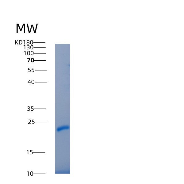 SDS-PAGE analysis of Human IL22RA2 (Interleukin-22 Receptor Subunit Alpha-2) - Recombinant Protein, CATHuman IL22RA2 (Interleukin-22 Receptor Subunit Alpha-2) - Recombinant Protein
