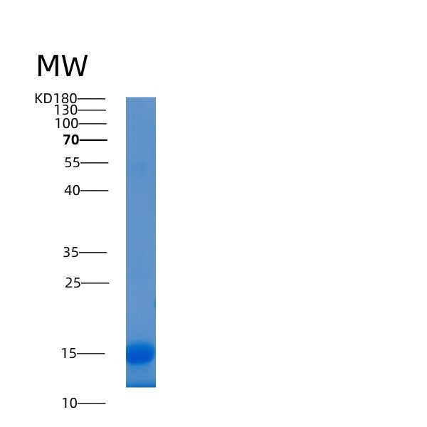 SDS-PAGE analysis of Human LAMTOR2 (Ragulator Complex Protein Lamtor2) - Recombinant Protein, CATHuman LAMTOR2 (Ragulator Complex Protein Lamtor2) - Recombinant Protein