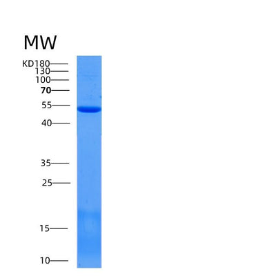 SDS-PAGE analysis of Mouse Scpep1 (Retinoid-Inducible Serine Carboxypeptidase) - Recombinant Protein, CAT# BLT-05340P, showing >85% purity under 15% SDS-PAGE (Reduced)Mouse Scpep1 (Retinoid-Inducible Serine Carboxypeptidase) - Recombinant Protein