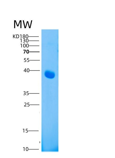 SDS-PAGE analysis of Human LAMP3 (Lysosome-Associated Membrane Glycoprotein 3) - Recombinant Protein, CAT# BLT-05341P, showing >95% purity under 15% SDS-PAGE (Reduced)Human LAMP3 (Lysosome-Associated Membrane Glycoprotein 3) - Recombinant Protein