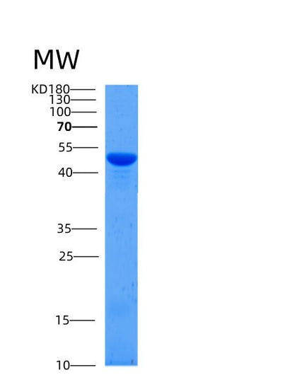 SDS-PAGE analysis of Mouse Serpinb12 (Serpin B12) - Recombinant Protein, CAT# BLT-05343P, showing >85% purity under 15% SDS-PAGE (Reduced)Mouse Serpinb12 (Serpin B12) - Recombinant Protein