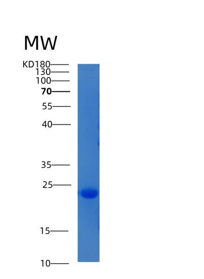 SDS-PAGE analysis of Human CIB2 (Calcium And Integrin-Binding Family Member 2) - Recombinant Protein, CAT# BLT-05345P, showing >90% purity under 15% SDS-PAGE (Reduced)Human CIB2 (Calcium And Integrin-Binding Family Member 2) - Recombinant Protein
