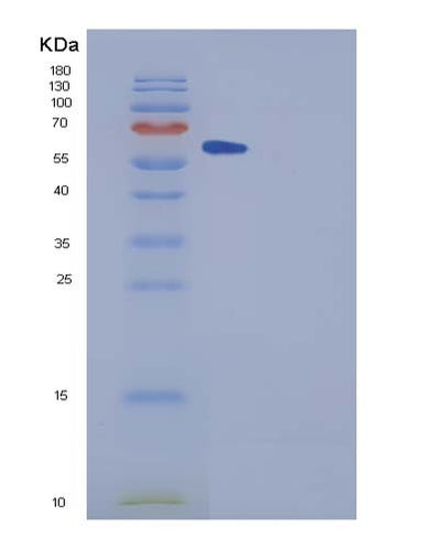 SDS-PAGE analysis of Human SPG21 (Maspardin) - Recombinant Protein, CAT# BLT-05349P, showing >85% purity under 15% SDS-PAGE (Reduced)Human SPG21 (Maspardin) - Recombinant Protein