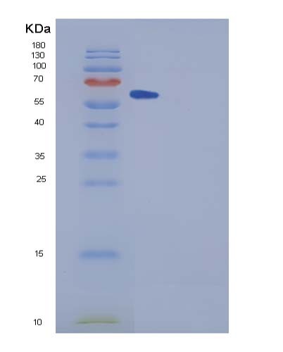 SDS-PAGE analysis of Human SPG21 (Maspardin) - Recombinant Protein, CATHuman SPG21 (Maspardin) - Recombinant Protein