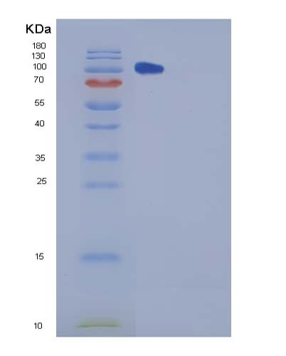 SDS-PAGE analysis of Mouse Chl1 (Neural Cell Adhesion Molecule L1-Like Protein) - Recombinant Protein, CATMouse Chl1 (Neural Cell Adhesion Molecule L1-Like Protein) - Recombinant Protein