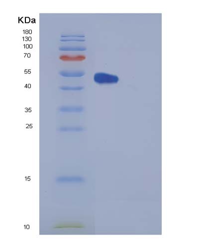 SDS-PAGE analysis of Human FKBP3 (Peptidyl-Prolyl Cis-Trans Isomerase Fkbp3) - Recombinant Protein, CATHuman FKBP3 (Peptidyl-Prolyl Cis-Trans Isomerase Fkbp3) - Recombinant Protein
