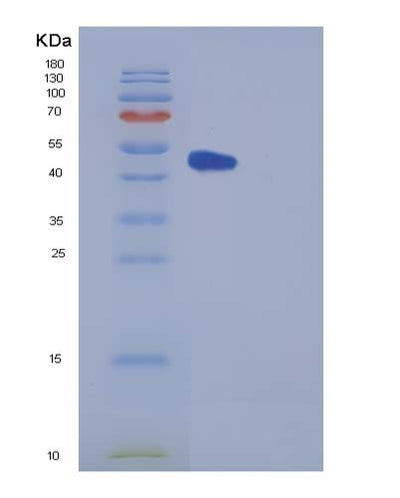 SDS-PAGE analysis of Human CPE (Carboxypeptidase E) - Recombinant Protein, CAT# BLT-05354P, showing >90% purity under 15% SDS-PAGE (Reduced)Human CPE (Carboxypeptidase E) - Recombinant Protein