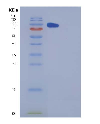 SDS-PAGE analysis of Human CPE (Carboxypeptidase E) - Recombinant Protein, CATHuman CPE (Carboxypeptidase E) - Recombinant Protein
