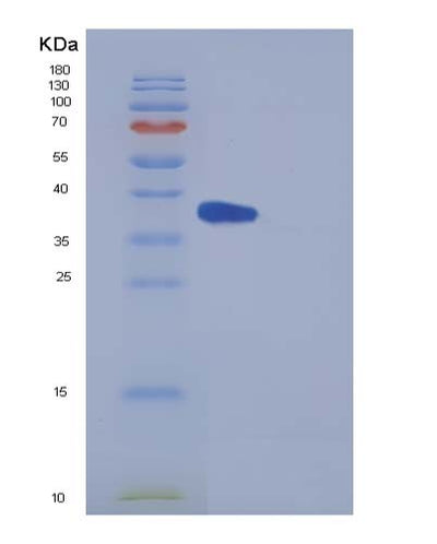 SDS-PAGE analysis of Mouse Il5ra (Interleukin-5 Receptor Subunit Alpha) - Recombinant Protein, CAT# BLT-05357P, showing >90% purity under 15% SDS-PAGE (Reduced)Mouse Il5ra (Interleukin-5 Receptor Subunit Alpha) - Recombinant Protein