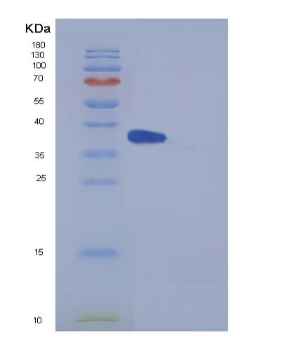 SDS-PAGE analysis of Mouse Il5ra (Interleukin-5 Receptor Subunit Alpha) - Recombinant Protein, CATMouse Il5ra (Interleukin-5 Receptor Subunit Alpha) - Recombinant Protein
