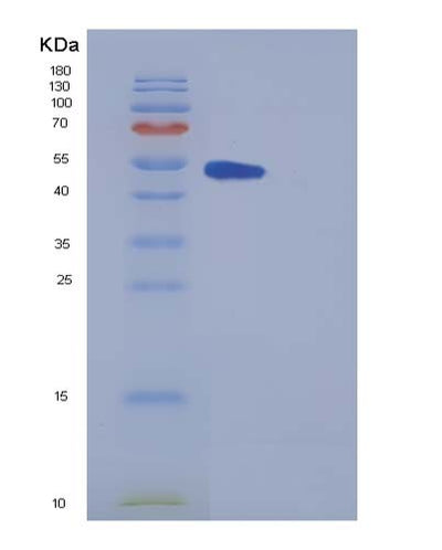 SDS-PAGE analysis of Mouse Metap2 (Methionine Aminopeptidase 2) - Recombinant Protein, CAT# BLT-05358P, showing >85% purity under 15% SDS-PAGE (Reduced)Mouse Metap2 (Methionine Aminopeptidase 2) - Recombinant Protein