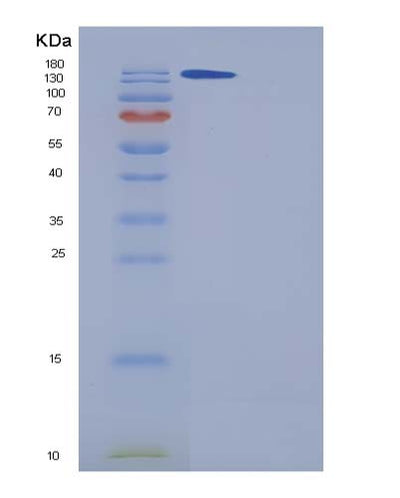 SDS-PAGE analysis of Human A2M (Alpha-2-Macroglobulin) - Recombinant Protein, CAT# BLT-05361P, showing >85% purity under 15% SDS-PAGE (Reduced)Human A2M (Alpha-2-Macroglobulin) - Recombinant Protein
