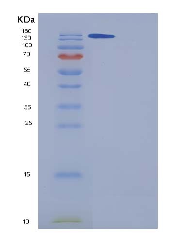 SDS-PAGE analysis of Human A2M (Alpha-2-Macroglobulin) - Recombinant Protein, CATHuman A2M (Alpha-2-Macroglobulin) - Recombinant Protein