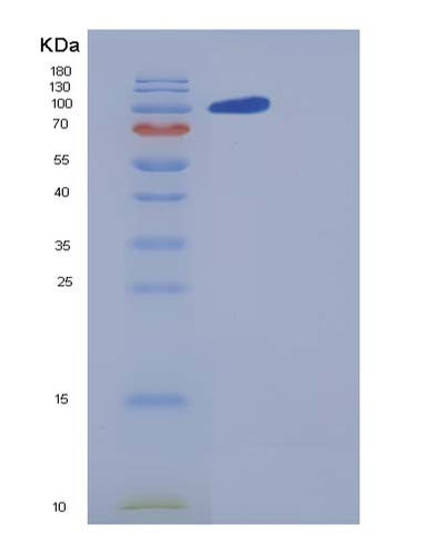 SDS-PAGE analysis of Human CNTN5 (Contactin-5) - Recombinant Protein, CAT# BLT-05364P, showing >85% purity under 15% SDS-PAGE (Reduced)Human CNTN5 (Contactin-5) - Recombinant Protein