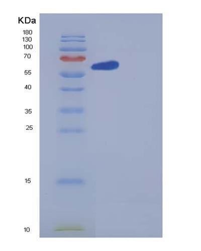 SDS-PAGE analysis of Human GBP1 (Guanylate-Binding Protein 1) - Recombinant Protein, CAT# BLT-05365P, showing >95% purity under 15% SDS-PAGE (Reduced)Human GBP1 (Guanylate-Binding Protein 1) - Recombinant Protein