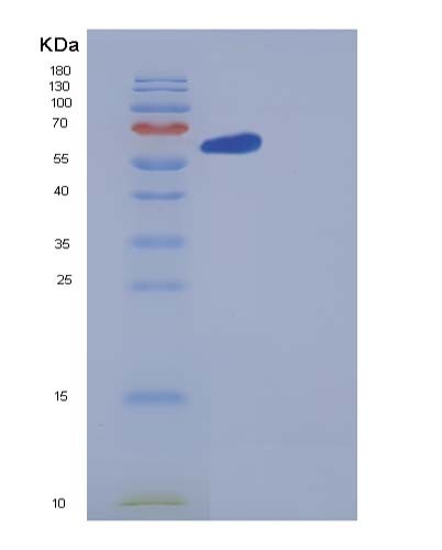 SDS-PAGE analysis of Human GBP1 (Guanylate-Binding Protein 1) - Recombinant Protein, CATHuman GBP1 (Guanylate-Binding Protein 1) - Recombinant Protein