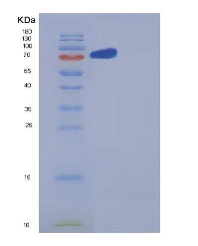 SDS-PAGE analysis of Human NRP2 (Neuropilin-2) - Recombinant Protein, CAT# BLT-05366P, showing >90% purity under 15% SDS-PAGE (Reduced)Human NRP2 (Neuropilin-2) - Recombinant Protein