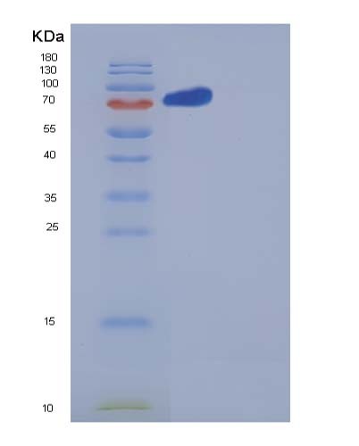SDS-PAGE analysis of Human NRP2 (Neuropilin-2) - Recombinant Protein, CATHuman NRP2 (Neuropilin-2) - Recombinant Protein