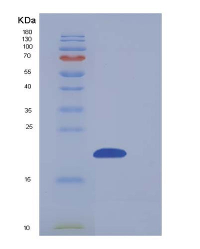 SDS-PAGE analysis of Human NUDT2 (Bis(5'-Nucleosyl)-Tetraphosphatase [Asymmetrical]) - Recombinant Protein, CAT# BLT-05369P, showing >90% purity under 15% SDS-PAGE (Reduced)Human NUDT2 (Bis(5'-Nucleosyl)-Tetraphosphatase [Asymmetrical]) - Recombinant Protein