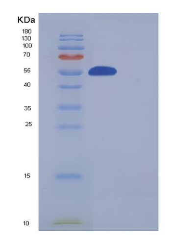 SDS-PAGE analysis of Human SMYD3 (Histone-Lysine N-Methyltransferase Smyd3) - Recombinant Protein, CAT# BLT-05370P, showing >85% purity under 15% SDS-PAGE (Reduced)Human SMYD3 (Histone-Lysine N-Methyltransferase Smyd3) - Recombinant Protein