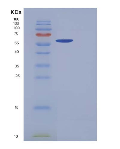 SDS-PAGE analysis of Human CDK5 (Cyclin-Dependent Kinase 5) - Recombinant Protein, CAT# BLT-05374P, showing >90% purity under 15% SDS-PAGE (Reduced)Human CDK5 (Cyclin-Dependent Kinase 5) - Recombinant Protein