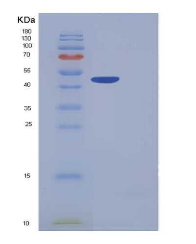 SDS-PAGE analysis of Human CPB1 (Carboxypeptidase B) - Recombinant Protein, CAT# BLT-05375P, showing >90% purity under 15% SDS-PAGE (Reduced)Human CPB1 (Carboxypeptidase B) - Recombinant Protein
