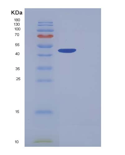 SDS-PAGE analysis of Human CPB1 (Carboxypeptidase B) - Recombinant Protein, CATHuman CPB1 (Carboxypeptidase B) - Recombinant Protein