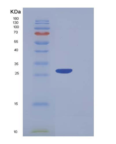 SDS-PAGE analysis of Human PF4V1 (Platelet Factor 4 Variant) - Recombinant Protein, CAT# BLT-05376P, showing >85% purity under 15% SDS-PAGE (Reduced)Human PF4V1 (Platelet Factor 4 Variant) - Recombinant Protein