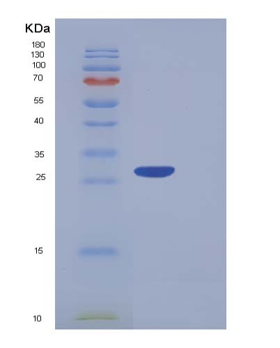 SDS-PAGE analysis of Human PF4V1 (Platelet Factor 4 Variant) - Recombinant Protein, CATHuman PF4V1 (Platelet Factor 4 Variant) - Recombinant Protein