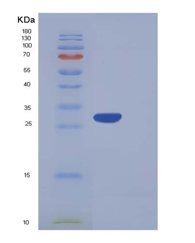 SDS-PAGE analysis of Human CA5A (Carbonic Anhydrase 5A, Mitochondrial) - Recombinant Protein, CAT# BLT-05377P, showing >95% purity under 15% SDS-PAGE (Reduced)Human CA5A (Carbonic Anhydrase 5A, Mitochondrial) - Recombinant Protein