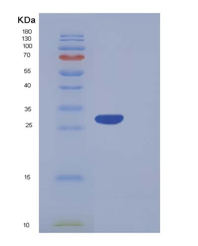 SDS-PAGE analysis of Human CA5A (Carbonic Anhydrase 5A, Mitochondrial) - Recombinant Protein, CATHuman CA5A (Carbonic Anhydrase 5A, Mitochondrial) - Recombinant Protein