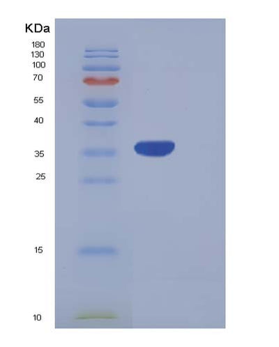 SDS-PAGE analysis of Human PRRG2 (Transmembrane Gamma-Carboxyglutamic Acid Protein 2) - Recombinant Protein, CAT# BLT-05378P, showing >90% purity under 15% SDS-PAGE (Reduced)Human PRRG2 (Transmembrane Gamma-Carboxyglutamic Acid Protein 2) - Recombinant Protein