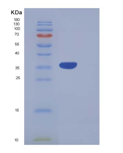 SDS-PAGE analysis of Human PRRG2 (Transmembrane Gamma-Carboxyglutamic Acid Protein 2) - Recombinant Protein, CATHuman PRRG2 (Transmembrane Gamma-Carboxyglutamic Acid Protein 2) - Recombinant Protein