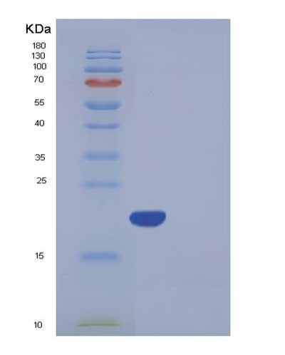 SDS-PAGE analysis of Human BNIP3L (Bcl2/Adenovirus E1B 19 Kda Protein-Interacting Protein 3-Like) - Recombinant Protein, CAT# BLT-05379P, showing >85% purity under 15% SDS-PAGE (Reduced)Human BNIP3L (Bcl2/Adenovirus E1B 19 Kda Protein-Interacting Protein 3-Like) - Recombinant Protein