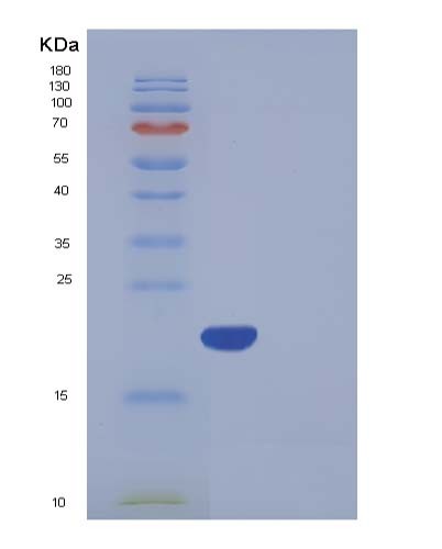 SDS-PAGE analysis of Human BNIP3L (Bcl2/Adenovirus E1B 19 Kda Protein-Interacting Protein 3-Like) - Recombinant Protein, CATHuman BNIP3L (Bcl2/Adenovirus E1B 19 Kda Protein-Interacting Protein 3-Like) - Recombinant Protein