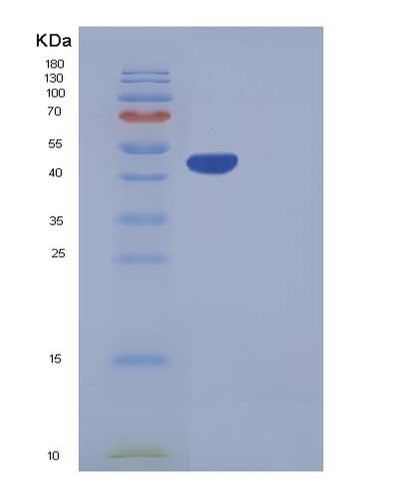 SDS-PAGE analysis of Human CPA2 (Carboxypeptidase A2) - Recombinant Protein, CAT# BLT-05380P, showing >95% purity under 15% SDS-PAGE (Reduced)Human CPA2 (Carboxypeptidase A2) - Recombinant Protein