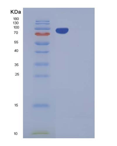 SDS-PAGE analysis of Mouse Cdcp1 (Cub Domain-Containing Protein 1) - Recombinant Protein, CAT# BLT-05381P, showing >90% purity under 15% SDS-PAGE (Reduced)Mouse Cdcp1 (Cub Domain-Containing Protein 1) - Recombinant Protein