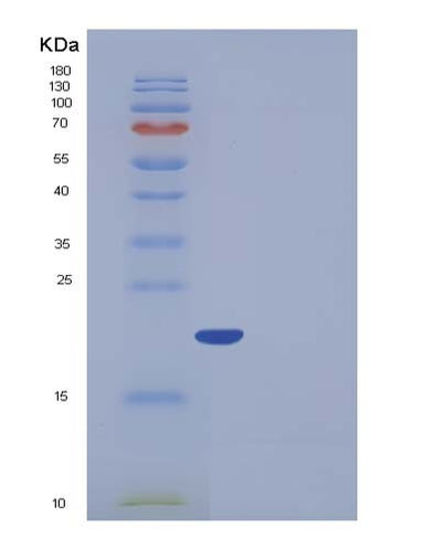 SDS-PAGE analysis of Human FTL (Ferritin Light Chain) - Recombinant Protein, CAT# BLT-05383P, showing >95% purity under 15% SDS-PAGE (Reduced)Human FTL (Ferritin Light Chain) - Recombinant Protein