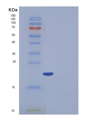SDS-PAGE analysis of Human FTL (Ferritin Light Chain) - Recombinant Protein, CATHuman FTL (Ferritin Light Chain) - Recombinant Protein