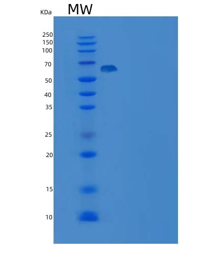SDS-PAGE analysis of Human DUSP14 (Dual Specificity Protein Phosphatase 14) - Recombinant Protein, CAT# BLT-05397P, showing >85% purity under 15% SDS-PAGE (Reduced)Human DUSP14 (Dual Specificity Protein Phosphatase 14) - Recombinant Protein