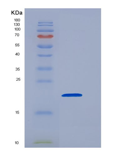 SDS-PAGE analysis of Mouse Cd8a (T-Cell Surface Glycoprotein Cd8 Alpha Chain) - Recombinant Protein, CAT# BLT-05413P, showing >90% purity under 15% SDS-PAGE (Reduced)Mouse Cd8a (T-Cell Surface Glycoprotein Cd8 Alpha Chain) - Recombinant Protein