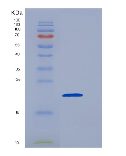 SDS-PAGE analysis of Mouse Cd8a (T-Cell Surface Glycoprotein Cd8 Alpha Chain) - Recombinant Protein, CATMouse Cd8a (T-Cell Surface Glycoprotein Cd8 Alpha Chain) - Recombinant Protein